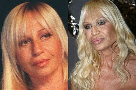 donatella versace neden bu hale geldi